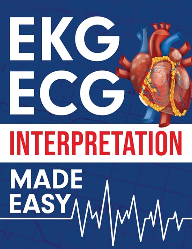 EKG/ECG Interpretation Made Easy: Illustrated ECG Study Guide for Stud