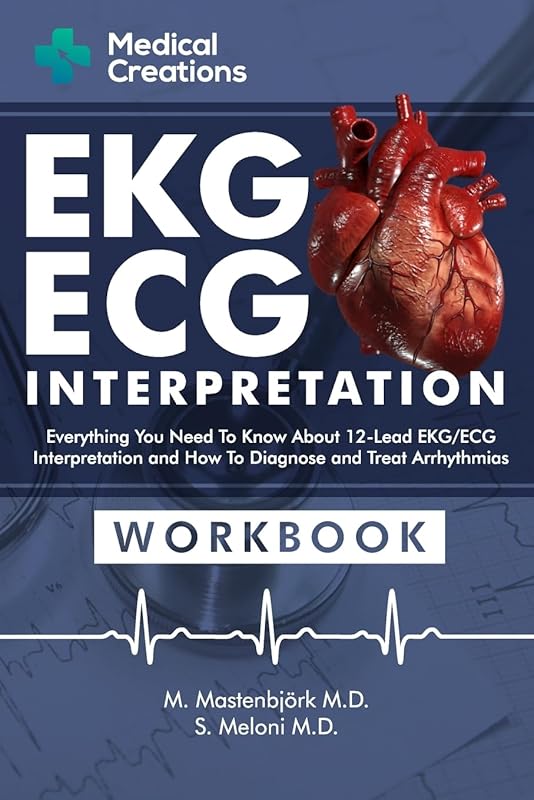EKG/ECG Interpretation Workbook: Master 12-Lead ECGs and Treat Arrhyth